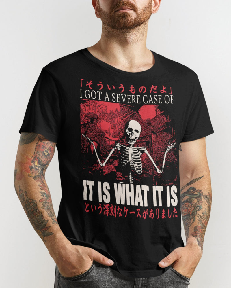 'Severe Case' Shirt